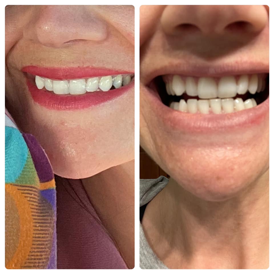 NuSkin Whitening Toothpaste